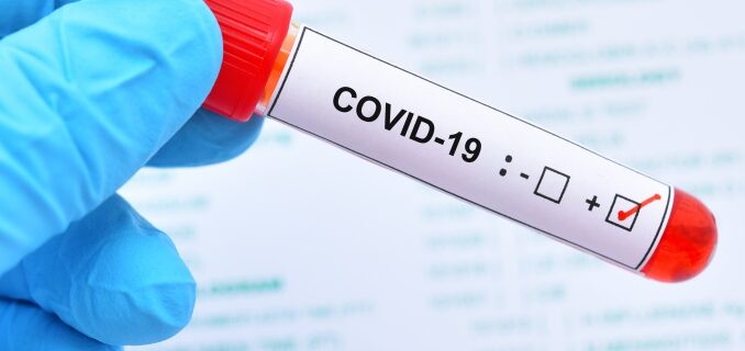 COVID-19